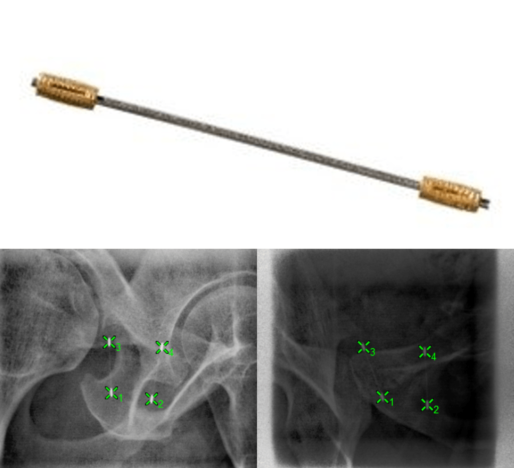 fiducials