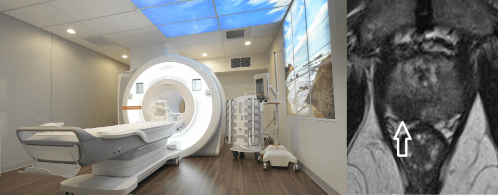 prostate_MRI