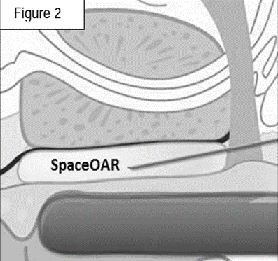 spaceoar_diagram_gel
